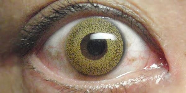 eye-diseases